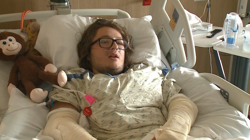 Logan Lackey, 18, is lucky to be alive after a motorcycle crash. His left leg was severed...